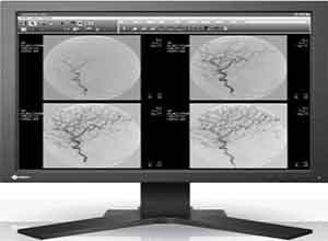 Eizo RadiForce Monochrome LCD Màn hình SMD 19102 Eizo RadiForce Monochrome LCD Màn hình SMD 19102