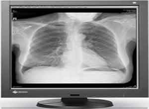 Eizo RadiForce GX340 Monochrome Màn hình LCD Eizo RadiForce GX340 Monochrome Màn hình LCD