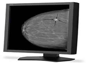 NEC 21 Inch Grayscale 5-Megapixel Medical Diagnostic Màn hình MD215MG NEC 21 Inch Grayscale 5-Megapixel Medical Diagnostic Màn hình MD215MG
