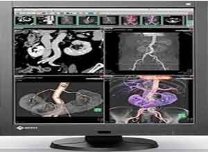 Eizo RadiForce RX340 21.2 Inch Color Màn hình LCD Eizo RadiForce RX340 21.2 Inch Color Màn hình LCD