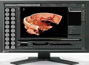 Eizo RadiForce 19 Inch Color LCD Màn hình RS110 Eizo RadiForce 19 Inch Color LCD Màn hình RS110