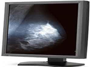 NEC 21 Inch 5MP medical diagnostic display MD211G5 NEC 21 Inch 5MP medical diagnostic display MD211G5