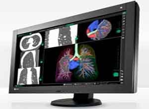 Eizo RadiForce GX240 Monochrome Màn hình LCD Eizo RadiForce GX240 Monochrome Màn hình LCD