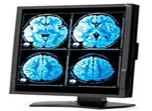 NEC Medical Diagnostic Display MD242C2 NEC Medical Diagnostic Display MD242C2