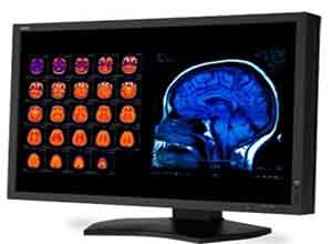 NEC 30 Inch Color 4-Megapixel Widescreen Medical Diagnostic Màn hình MD301C4 NEC 30 Inch Color 4-Megapixel Widescreen Medical Diagnostic Màn hình MD301C4